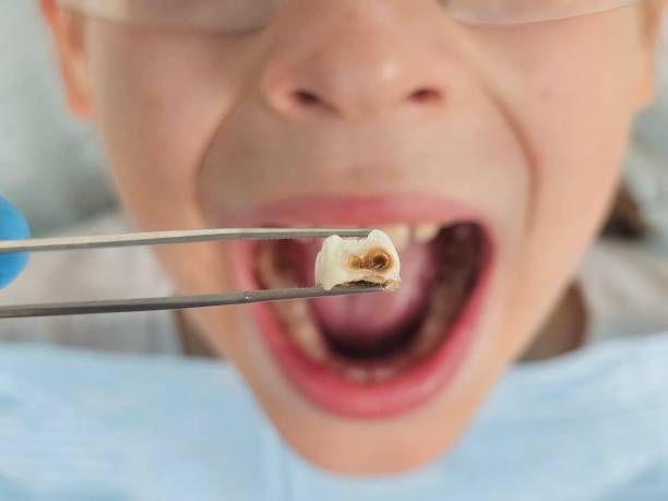 Best Broken Tooth Emergency  in Kingsville, TX